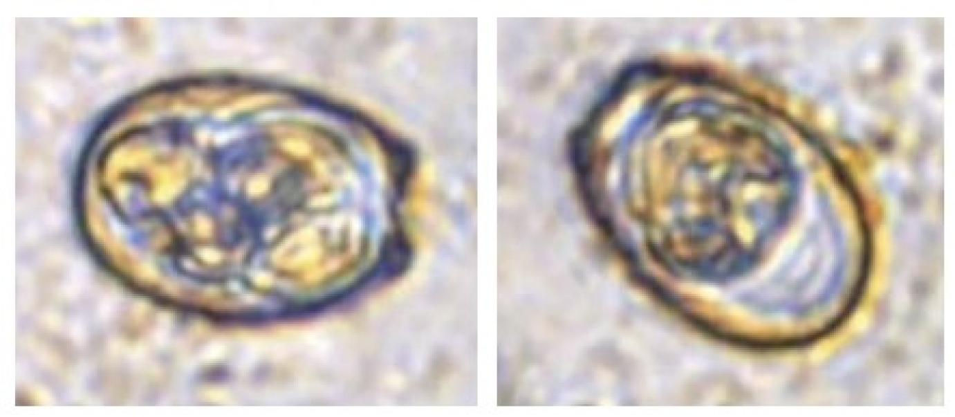 HÁZI NYULAK KOKCIDIÓZISVIZSGÁLATA