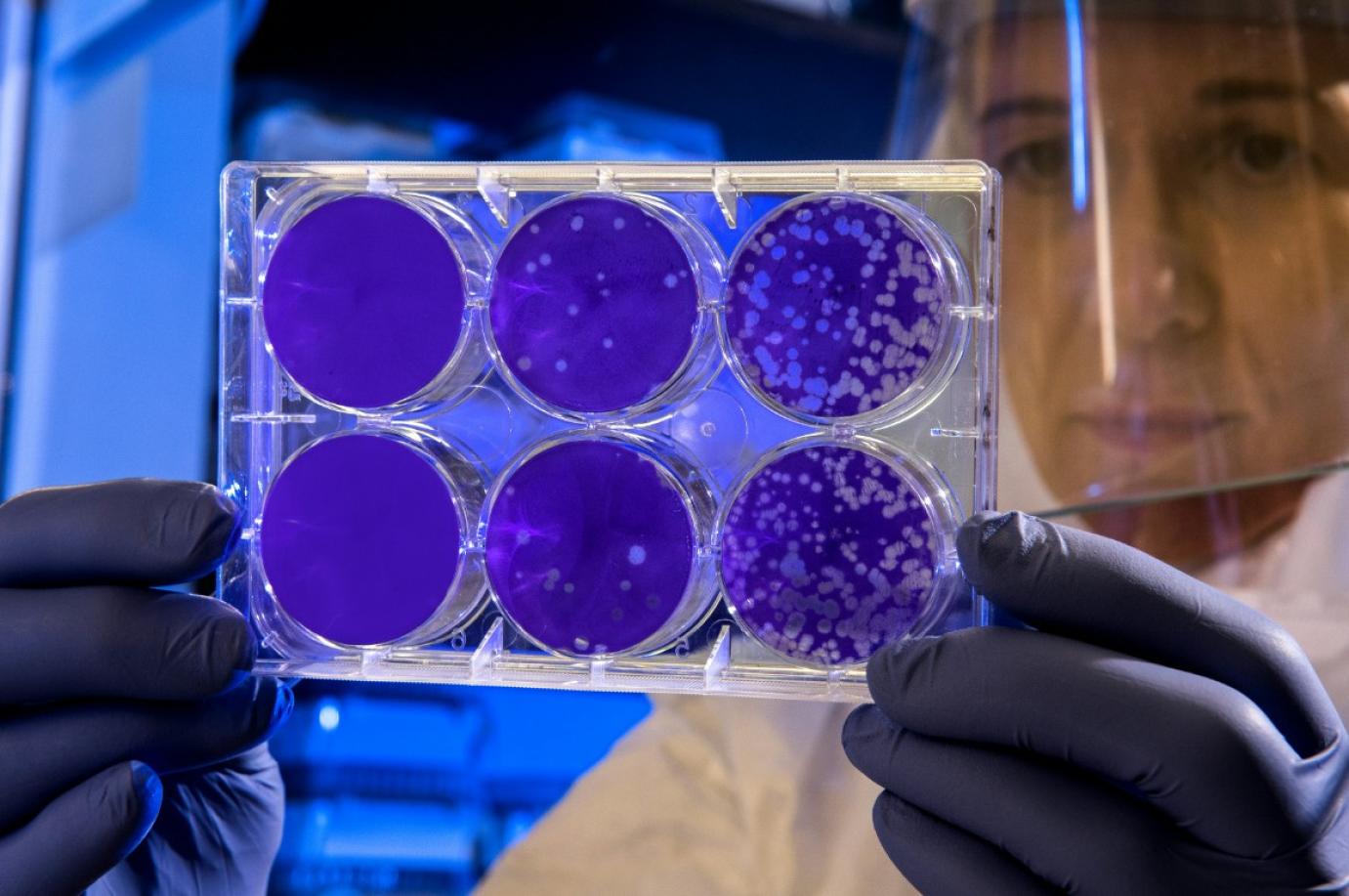 Az antibiotikumok helyes használatával és a betegségek megelőzésével csökkenthető az AMR kialakulásának kockázata